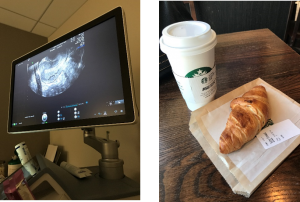 My first ultrasound and my after ultrasound treat!
