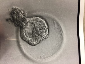 Our little blastocyst