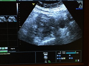 blog 5 ultrasound pic