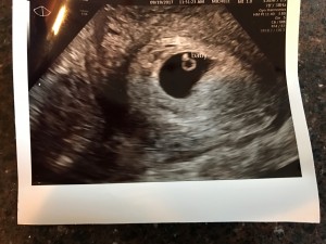 Our 7 week ultrasound