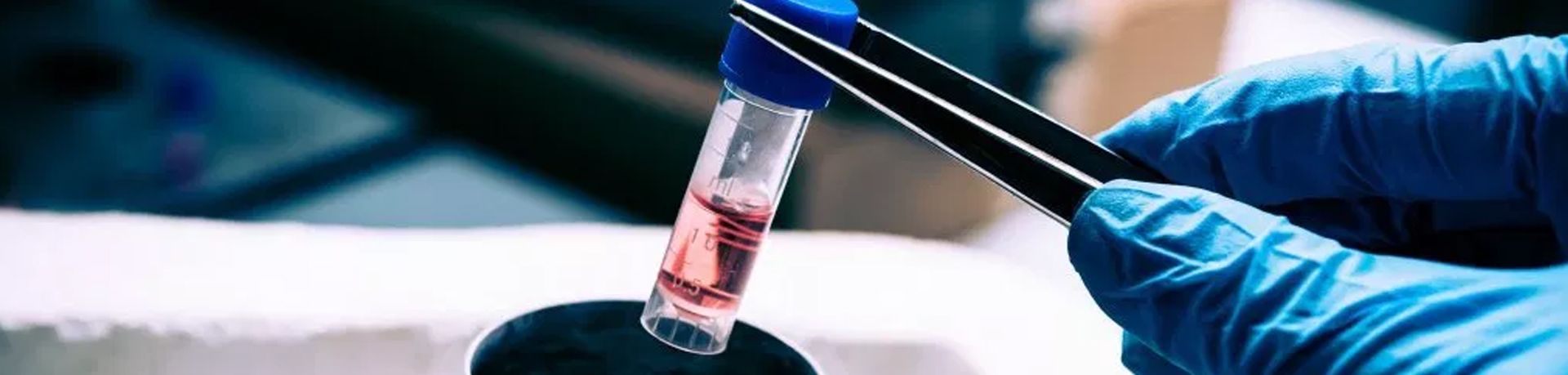 sperm storage center